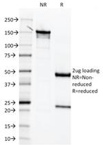 Mesothelin (Mesothelial Marker) Antibody in SDS-PAGE (SDS-PAGE)