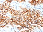 Mesothelin Antibody in Immunohistochemistry (Paraffin) (IHC (P))