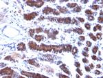 Mesothelin Antibody in Immunohistochemistry (Paraffin) (IHC (P))