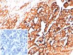 Mesothelin (Mesothelial Marker) Antibody in Immunohistochemistry (Paraffin) (IHC (P))