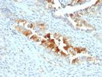 Mesothelin (Mesothelial Marker) Antibody in Immunohistochemistry (Paraffin) (IHC (P))