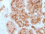 Mesothelin (Mesothelial Marker) Antibody in Immunohistochemistry (Paraffin) (IHC (P))