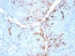 Mesothelin (Mesothelial Marker) Antibody in Immunohistochemistry (Paraffin) (IHC (P))