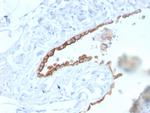 Mesothelin (Mesothelial Marker) Antibody in Immunohistochemistry (Paraffin) (IHC (P))