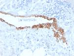 Mesothelin (Mesothelial Marker) Antibody in Immunohistochemistry (Paraffin) (IHC (P))