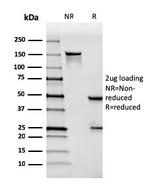 Mesothelin (Mesothelial Marker) Antibody in SDS-PAGE (SDS-PAGE)