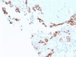 Mesothelin (Mesothelial Marker) Antibody in Immunohistochemistry (Paraffin) (IHC (P))