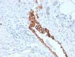 Mesothelin (Mesothelial Marker) Antibody in Immunohistochemistry (Paraffin) (IHC (P))