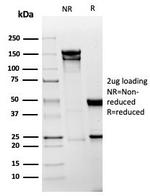 Mesothelin (Mesothelial Marker) Antibody in SDS-PAGE (SDS-PAGE)