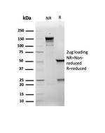 p21WAF1 (Tumor Suppressor Protein) Antibody in SDS-PAGE (SDS-PAGE)