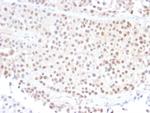 p21WAF1 (Tumor Suppressor Protein) Antibody in Immunohistochemistry (Paraffin) (IHC (P))