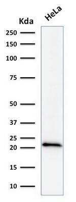 p21WAF1 (Tumor Suppressor Protein) Antibody in Western Blot (WB)