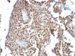 p21WAF1 (Tumor Suppressor Protein) Antibody in Immunohistochemistry (Paraffin) (IHC (P))