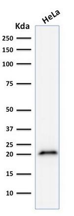 p21WAF1 (Tumor Suppressor Protein) Antibody in Western Blot (WB)