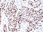 p21WAF1 (Tumor Suppressor Protein) Antibody in Immunohistochemistry (Paraffin) (IHC (P))