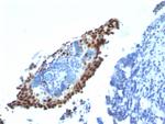 p21WAF1 (Tumor Suppressor Protein) Antibody in Immunohistochemistry (Paraffin) (IHC (P))