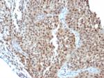 p21WAF1 (Tumor Suppressor Protein) Antibody in Immunohistochemistry (Paraffin) (IHC (P))