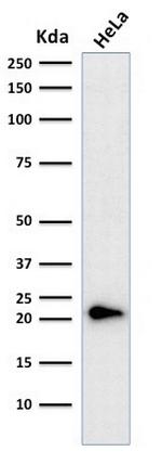 p21WAF1 (Tumor Suppressor Protein) Antibody in Western Blot (WB)