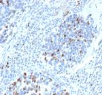 p21WAF1 (Tumor Suppressor Protein) Antibody in Immunohistochemistry (Paraffin) (IHC (P))