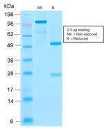 p21WAF1 (Tumor Suppressor Protein) Antibody in SDS-PAGE (SDS-PAGE)