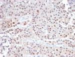 p21WAF1 (Tumor Suppressor Protein) Antibody in Immunohistochemistry (Paraffin) (IHC (P))