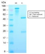 p21WAF1 (Tumor Suppressor Protein) Antibody in SDS-PAGE (SDS-PAGE)