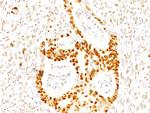 p27Kip1 (Mitotic Inhibitor/Suppressor Protein) Antibody in Immunohistochemistry (Paraffin) (IHC (P))