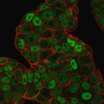 p27Kip1 (Mitotic Inhibitor/Suppressor Protein) Antibody in Immunocytochemistry (ICC/IF)