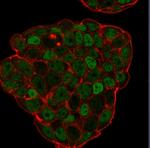 p27Kip1 (Mitotic Inhibitor/Suppressor Protein) Antibody in Immunocytochemistry (ICC/IF)