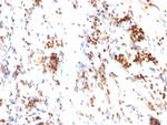 p27Kip1 (Mitotic Inhibitor/Suppressor Protein) Antibody in Immunohistochemistry (Paraffin) (IHC (P))