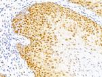 p27Kip1 (Mitotic Inhibitor/Suppressor Protein) Antibody in Immunohistochemistry (Paraffin) (IHC (P))