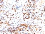 p27Kip1 (Mitotic Inhibitor/Suppressor Protein) Antibody in Immunohistochemistry (Paraffin) (IHC (P))