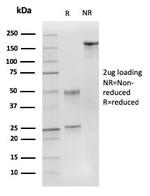 p27Kip1 (Mitotic Inhibitor/Suppressor Protein) Antibody in SDS-PAGE (SDS-PAGE)