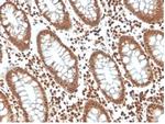 p27Kip1 (Mitotic Inhibitor/Suppressor Protein) Antibody in Immunohistochemistry (Paraffin) (IHC (P))