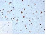 p27Kip1 (Mitotic Inhibitor/Suppressor Protein) Antibody in Immunohistochemistry (Paraffin) (IHC (P))