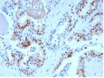 p27Kip1 (Mitotic Inhibitor/Suppressor Protein) Antibody in Immunohistochemistry (Paraffin) (IHC (P))