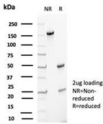 p27Kip1 (Mitotic Inhibitor/Suppressor Protein) Antibody in SDS-PAGE (SDS-PAGE)