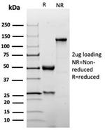 p27Kip1 (Mitotic Inhibitor/Suppressor Protein) Antibody in SDS-PAGE (SDS-PAGE)