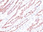 p57Kip2 (Mitotic Inhibitor/Suppressor Protein) Antibody in Immunohistochemistry (Paraffin) (IHC (P))