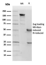 p57Kip2 (Mitotic Inhibitor/Suppressor Protein) Antibody in SDS-PAGE (SDS-PAGE)