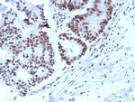 p57Kip2 (Mitotic Inhibitor/Suppressor Protein) Antibody in Immunohistochemistry (Paraffin) (IHC (P))