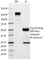 p57Kip2 (Mitotic Inhibitor/Suppressor Protein) Antibody in SDS-PAGE (SDS-PAGE)