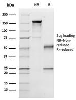 p57Kip2 (Mitotic Inhibitor/Suppressor Protein) Antibody in SDS-PAGE (SDS-PAGE)