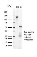 p57Kip2 (Mitotic Inhibitor/Suppressor Protein) Antibody in SDS-PAGE (SDS-PAGE)