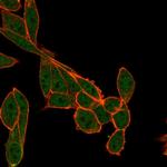 SMNDC1 Antibody in Immunocytochemistry (ICC/IF)