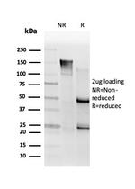 SMNDC1 Antibody in SDS-PAGE (SDS-PAGE)