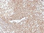 P16INK4a Antibody in Immunohistochemistry (Paraffin) (IHC (P))