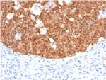 P16INK4a Antibody in Immunohistochemistry (Paraffin) (IHC (P))