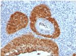 P16INK4a Antibody in Immunohistochemistry (Paraffin) (IHC (P))