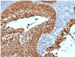 P16INK4a Antibody in Immunohistochemistry (Paraffin) (IHC (P))